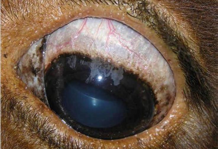 Kystes typiques dans le blanc de l’œil.