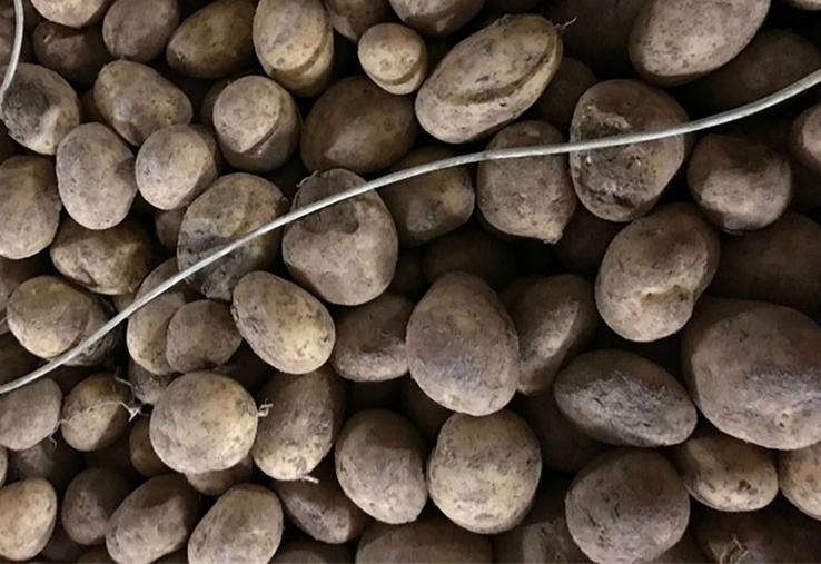 Brûlure post-thermonébulisation, au contact du câble de sonde avec la formation de gouttelettes. 