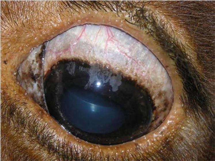 Kystes typiques dans le blanc de l’œil.