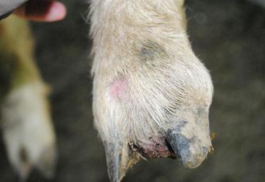 L’espace interdigité et la couronne sont gonflés : c’est un panaris.