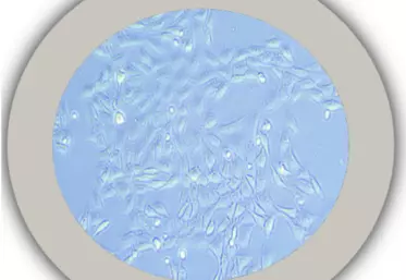 Test colorimétrique qui mesure l'activité métabolique des cellules comme indicateur de la prolifération cellulaire