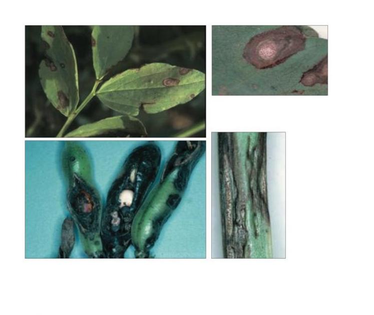 Symptômes d'anthracnose sur féverole. (Source: Arvalis - Institut du végétal)