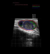Bovintel Fertility IMV Technologies