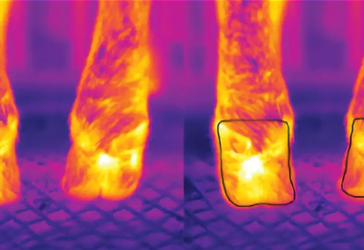 Les caméras mesurent le rayonnement infrarouge émis et mettent en évidence l’inflammation du pied. 