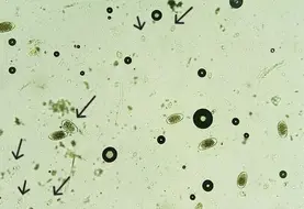 <em class="placeholder">coproscopie comptage d'oeufs de Eimeria bovis coccidiose pathogène</em>