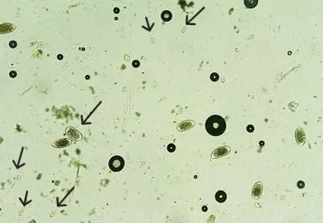 <em class="placeholder">coproscopie comptage d'oeufs de Eimeria bovis coccidiose pathogène</em>