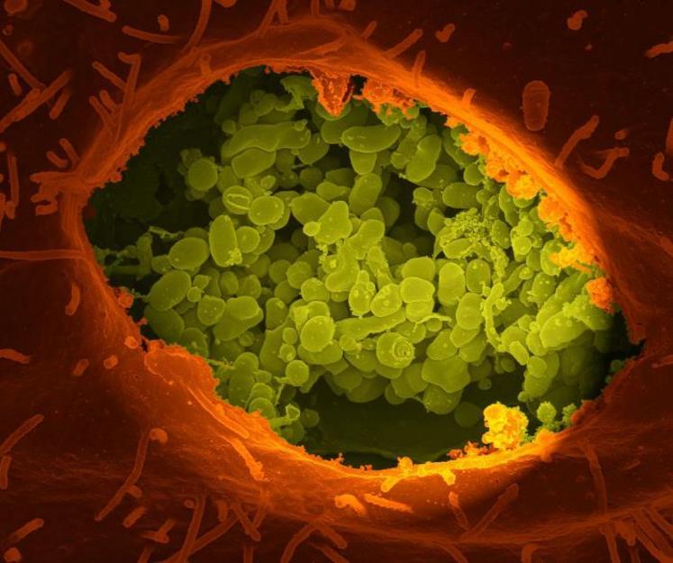 La bactérie de la fièvre Q est capable de se maintenir dans les cellules mêmes de l'immunité.
