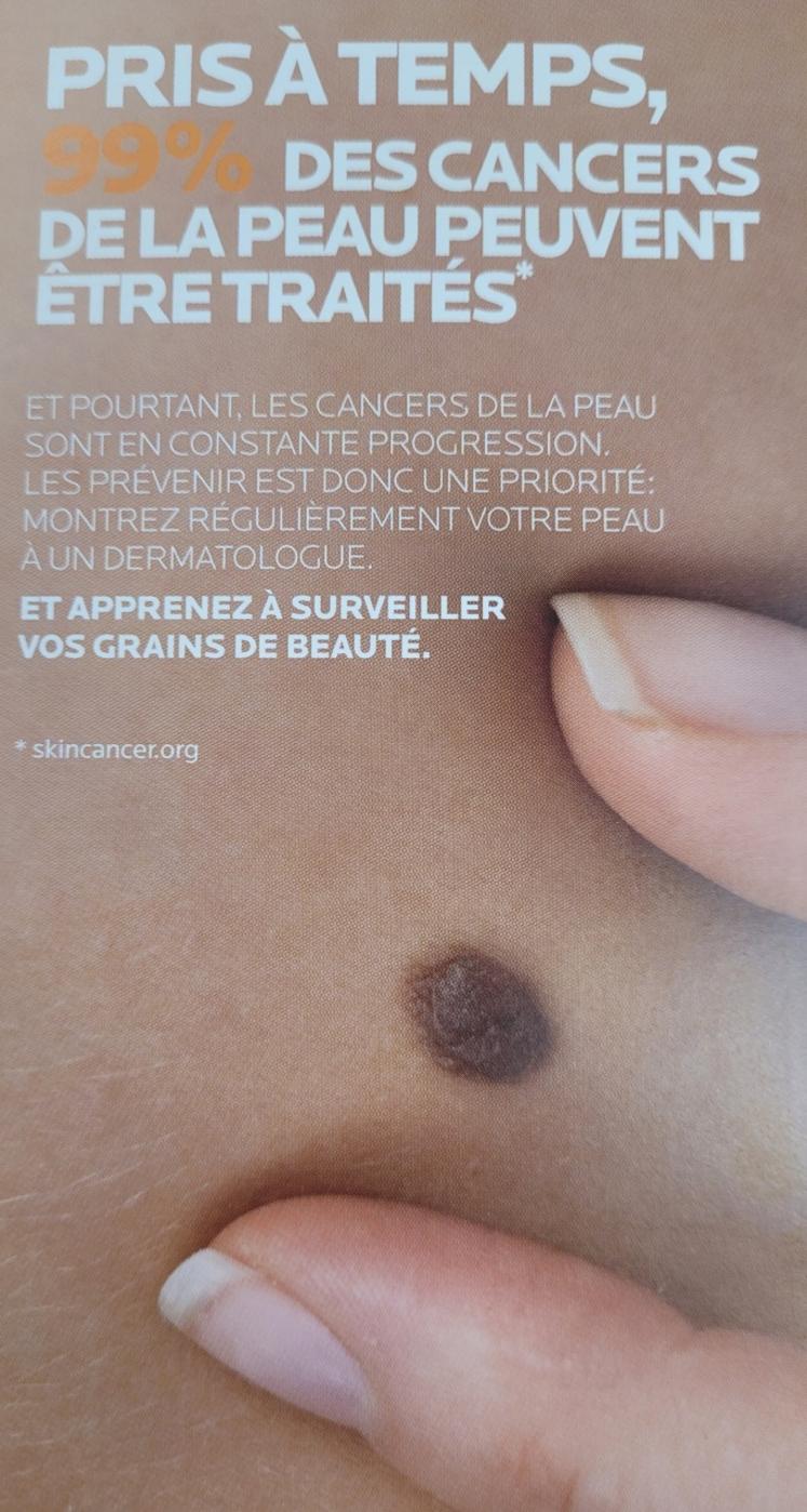Un grain de beauté ne devient pas un cancer. Il important de consulter.