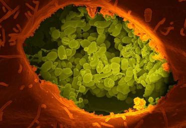 La bactérie de la fièvre Q est capable de se maintenir dans les cellules mêmes de l'immunité.