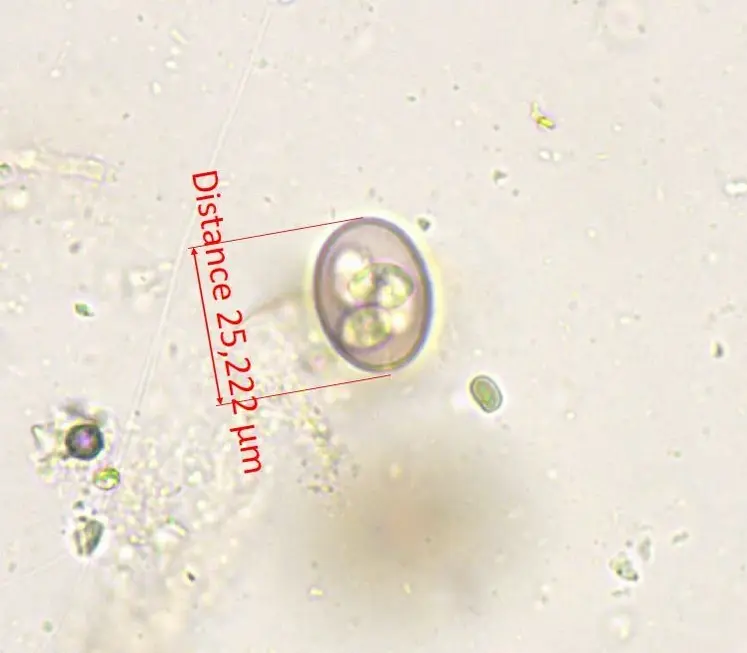 <em class="placeholder">Eimeria caprina</em>