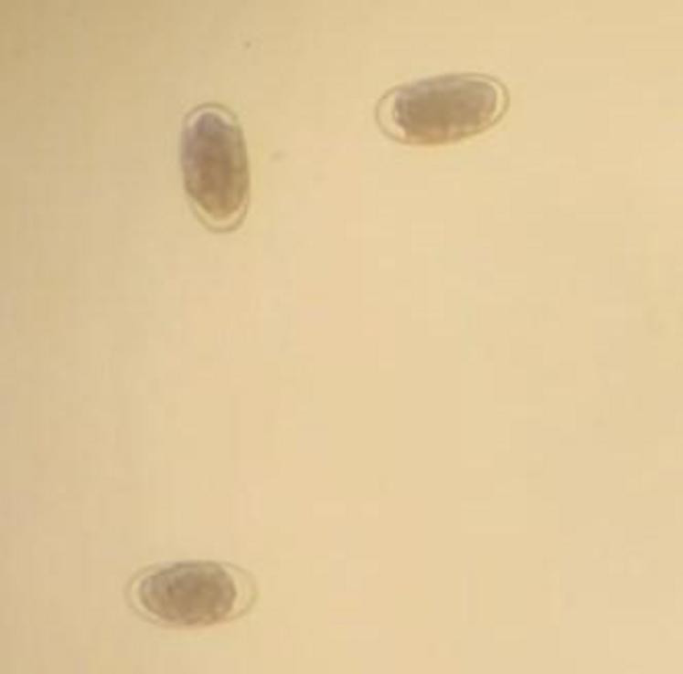 Strongle digestif au microscope chez une brebis présentant un affaiblissement (analyse faite le 6/09/23).