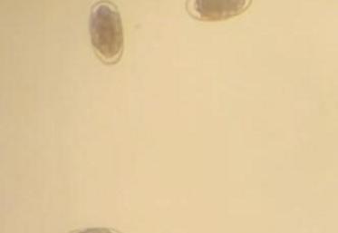 Strongle digestif au microscope chez une brebis présentant un affaiblissement (analyse faite le 6/09/23).