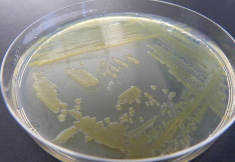 Les bactériophages sont sélectionnés en laboratoire sur une culture de bactéries Xanthomonas en boîte de pétri.