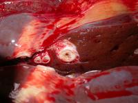 <em class="placeholder">lésion de douves dans le foie d'un bovin</em>