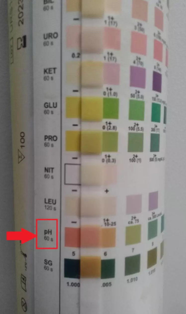 Un pH urinaire entre 5 et 6 signe une acidose.