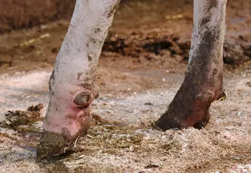 Le panaris est la seule pathologie du pied qui nécessite un traitement antibiotique en première intention. © M. Delacroix