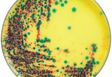 Les fournisseurs étendent leurs tests à la détection des salmonelles mobiles et immobiles. La majorité des sérotypes de salmonelles sont diphasiques et expriment les deux phases flagellaires. Certains sérotypes perdent la phase 2.