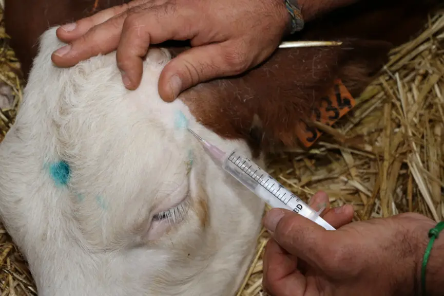 3 Injection de l’anesthésique local. (deux photos à accoler) Elle est réalisée en deux points précis à 1 centimètre sous la peau : -1- 4 ml le long de