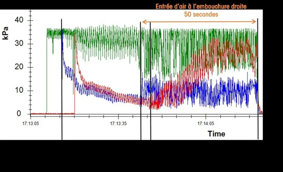 Enregistrement des fluctuations du vide avec un VaDia pendant la traite d’une chèvre. Visualisation d’une entrée d’air de 50 secondes due à un maintie