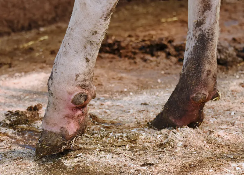 Le panaris est la seule pathologie du pied qui nécessite un traitement antibiotique en première intention. © M. Delacroix