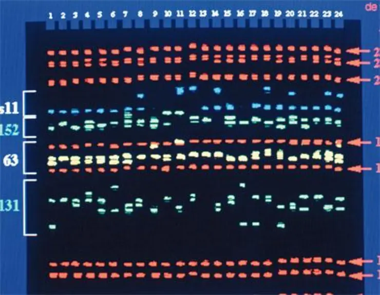 Écran de visualisation d’une séquence d’ADN, sur l’ordinateur qui pilote le séquenceur. La génomique offre la possibilité de sélectionner sur de nouve