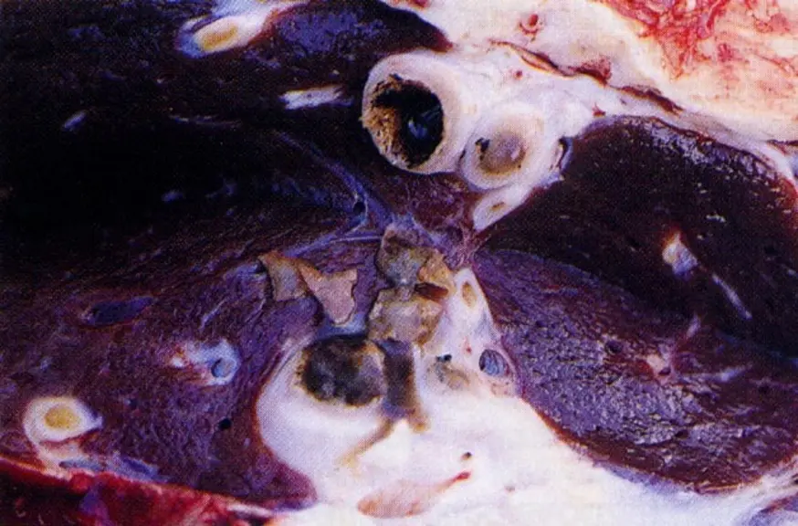 Le cycle de ces parasites est comparable mais ils sont pourtant très différents. La grande douve est plate, en forme de lance et vit dans le foie, où