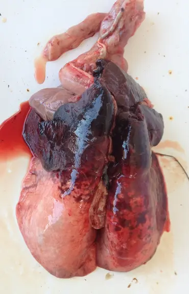 17 - LESIONS EXTENSIVES DE PNEUMONIE © P. Autef