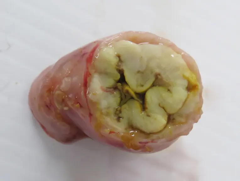 L'iléite porcine induit un épaississement de la muqueuse idéale avec de nombreux replis, prenant la forme d’un cerveau. © MSD Santé Animale