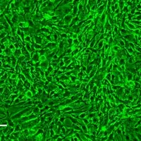 La lignée AmE-711 présente un phénotype caractéristique des fibroblastes. Microscopie à contraste de phase (x200). Barre d’échelle = 50 µm
