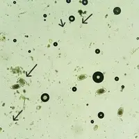 coproscopie comptage d'oeufs de Eimeria bovis coccidiose pathogène