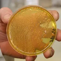 Boite de Petri avec culture bactérienne