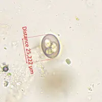 Eimeria caprina
