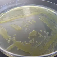 Les bactériophages sont sélectionnés en laboratoire sur une culture de bactéries Xanthomonas en boîte de pétri.