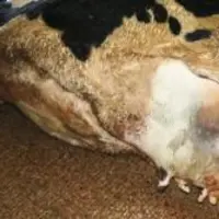UNE MAMELLE BLEUE et une hématome
autour de la veine mammaire.