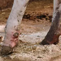 Le panaris est la seule pathologie du pied qui nécessite un traitement antibiotique en première intention. © M. Delacroix