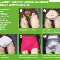 la réalisation du pansement à l'acide salicylique pour les pieds de bovins en 5 étapes