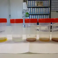 Pour la couleur des urines, il faut viser une couleur «vin blanc sec» et non «jus de pomme» ou «eau de roche».  © E. Laffont
