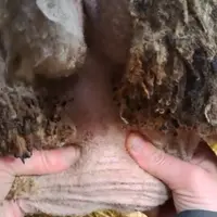 Palpation de la mammelle