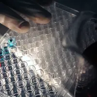 Sérologie en laboratoire, test Elisa