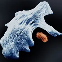 Les amibes sont des micro-organismes unicellulaires. L'une d'elle, Willaertia magna, pourrait bientôt devenir une substance active de lutte contre le