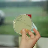 Bovins lait / sécurité sanitaire /analyse microbiologique du lait/ germes pathogènes / colonie de Listeria monocytogenes en boîte de pétri