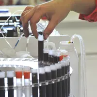 Détail de l'appareil Ã  flux continu, pour doser les sucres réducteurs l'acidité volatile et dioyde de soufre. Mise