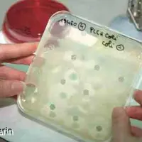 Lecture d’un antibiogramme. Les prescriptions des fluroquinolones et des céphalosporines seront plus strictement encadrées.