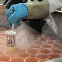 Prevexxion est fabriqué en France et disponible en 1000, 2000 et 4000 doses, congelées dans de l’azote liquide, avec un service logistique dédié pour