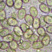 Tapis d’oocystes d’E. acervulina non sporulées. Très fréquente, cette espèce entraîne rarement des signes cliniques mais elle a un impact fort sur la