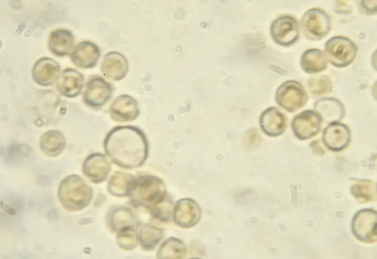 <em class="placeholder">Utilisation de levures. Saccharomyces cerevisiae.</em>