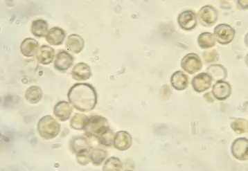 <em class="placeholder">Utilisation de levures. Saccharomyces cerevisiae.</em>