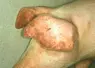 <em class="placeholder">Un animal contaminé par le virus de la FPA peut développer des rougeurs sur la peau.</em>