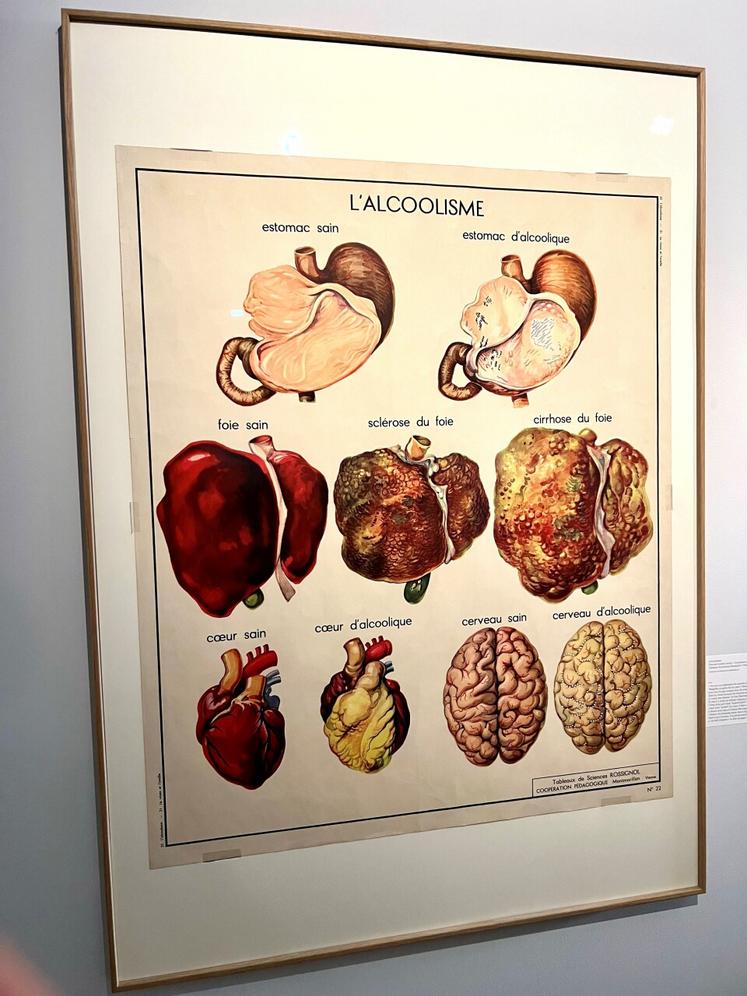 Des affiches ont été imprimées pour montrer les dégâts des alcools sur les organes.