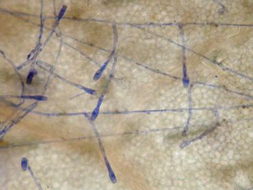 mycélium d'oïdium sur feuille